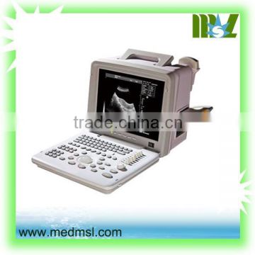 best ultrasound machine with best ultrasonic machine price, diagnostic scanner MSLPU01W