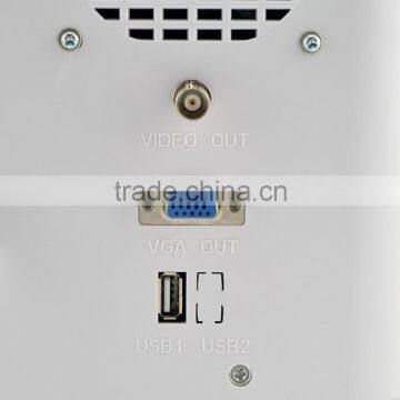 Good Image Ultrasonic Machine Ultrasound Scanner With Multi Frequency Probe RUS-9000B CE ISO Mark photo-3