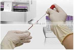 BIOBASE 5-Part Auto Hematology Analyzer 60Tests/hour 3D Technology BK-6500 Auto Blood Cell Counter for Laboratory or Hospital photo-4