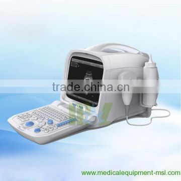 Laptop Ultrasound Machine MSLPU05W with High Level Ultrasound System and Excellent Ultrasound Performance