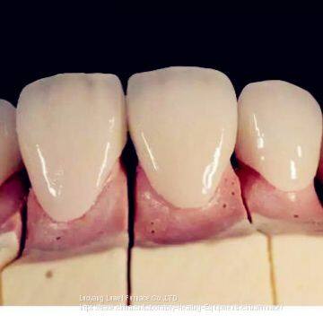 Factory Direct Dental Lab Supply Quality Zirconia Sintering Dental Lab Equipment photo-5