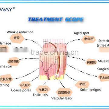 Medical Surgery Cutting Fractional Co2 Laser Vaginal America Emitter photo-2