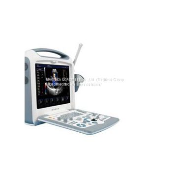 Escaner De Ultrasound Portatil En Color S8I Con 2 Sondas