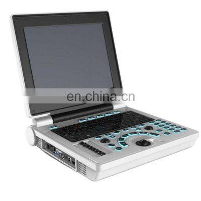 12 inch HD LCD monitor full digital  Portable medical ultrasound instruments color doppler ultrasound