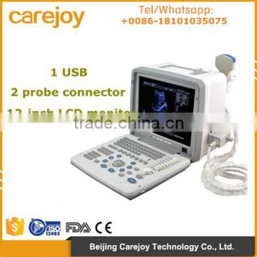 Portable 12 inch multi frequency probe Ultrasound Machine/Scanner for hospital clinic community RUS-9000B