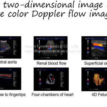 China Trolley 4D Color Doppler Ultrasound (YJ-U10T) photo-5