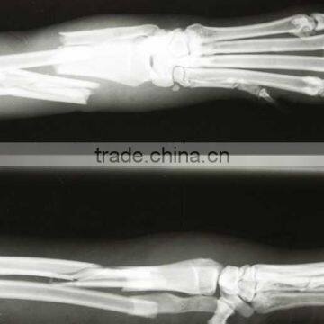 medical thermal x ray film,x ray film processor,conventional roentgenogram