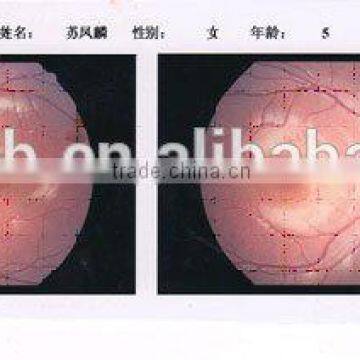 China MCT-A/High-end MCT Technology For Child Amblyopia photo-2