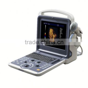 2016 new laoptap 3d/4d ultrasound color doppler for human with digital