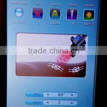 Advanced Vacuum Roller Massager Slimming Machine Cellulite Machine photo-2