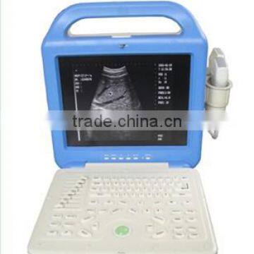 2016 LCD Display Ultrasound Scanner with Convex Probe