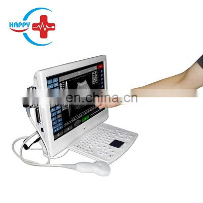 HC-A005   New portable digital B Ultrasound for  Pregnant women/hospitals,etc.