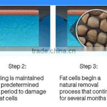 Portable Kryolipolyse With Two Heads Weight Loss Beauty Machine photo-6