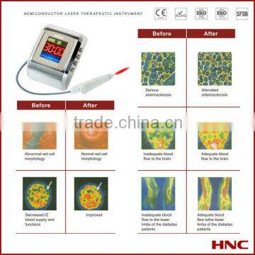 New technology product 2013 China Type 1 Diabetes Treatment