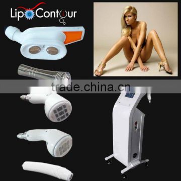 Vacuum Cavitation Liposuction And RF For Weight Loss