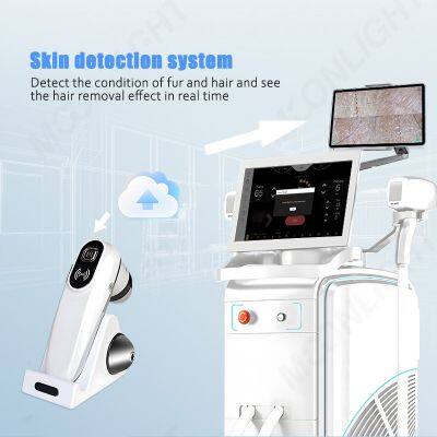Aesthetic Medicine 4 Wavelengths 808nm Diode Hair Removal Laser Machine photo-5