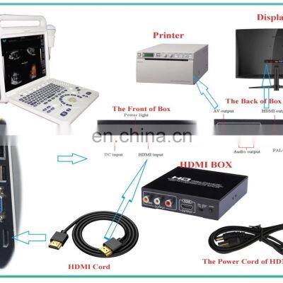 Hot Selling Medical Cheapest-portable-ultrasound-machine for Hospital and Clinic Use photo-3