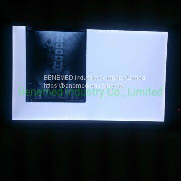 Ultra Slim LED Hospital X-ray Film Viewer Double Section photo-2