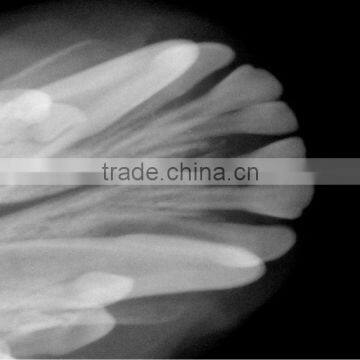 Battery Powered Mobile Digital X-Ray photo-4