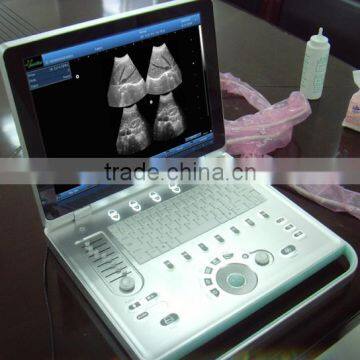 Sonostar Hospital Veterinary Equipment B Model Ultrasound Machine for Sale V9 photo-3