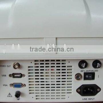 CE Approved Portable B-Mode Ultrasound Scanner With 3.5Mhz Multi-frequency Convex Probe RUS-6000A photo-4