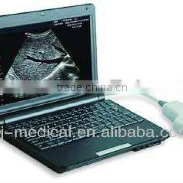 AJ-6000Plus High Performance User-friendly Control Long Lifetime Full Digital Laptop Ultrasound Scanner