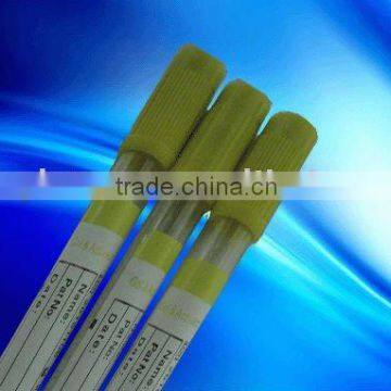 5ml SST tube(CE \ ISO13485 \ ISO9001)