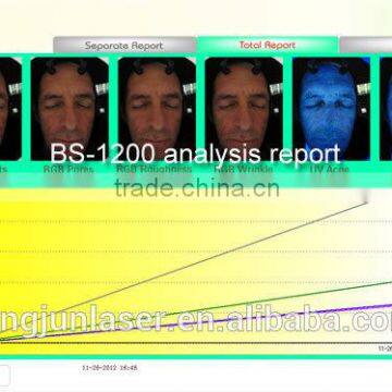 Hot-selling Made in China Smart System Digital Dermatoscope Professional Portable 3d Skin Analyzer