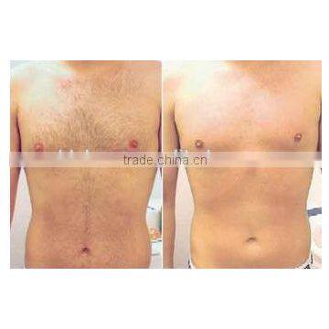 Permanent 808nm Diode Laser Bode Hair Removal With No Pain Arm / Chest Hair Removal photo-4
