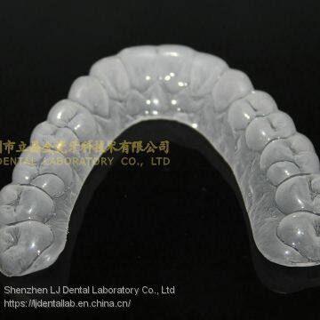 Night Guard, Night Guard, Orthodontic Appliances, Hawley Retainer, Dental Orthodontic Appliance, Laboratoire Dentaire, Dentallabor, Laboratorio Dental, Dental Laboratory, Shenzhen LJ Dental Lab China photo-2