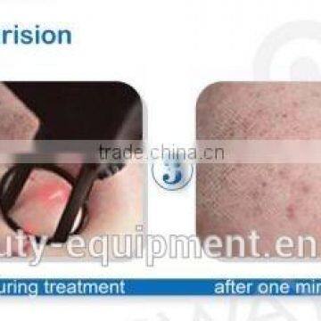 RF Pipe Fractional Co2 Carboxytherapy Laser Vaginal Tightening Machine Treat Telangiectasis photo-4