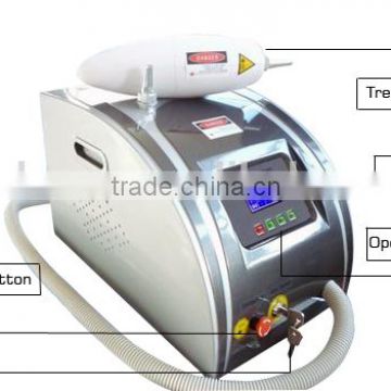 1000W Qts 2016 Q Switch Nd Yag Laser /tattoo Removal Machine /laser Tattoo Removal Naevus Of Ito Removal