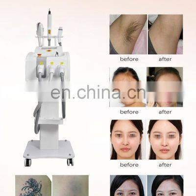 Portable 3 in 1 DPL IPL Picosecond Laser Machine for Pigment Acne Hair Removal Skin Regeneration