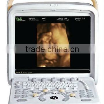 MC-DU-Q8 Portable OB/GYN 3D/4D Cardiac Color Doppler Ultrasound Scanner