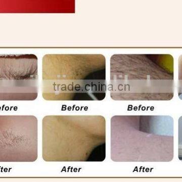 Skin Lifting Professional Ipl Hair Removal And Facial Rejuvenation Machine Hair Removal photo-2