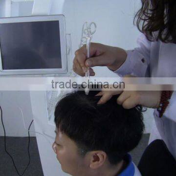 Top Sale 650nm Diode Laser Best Hair Regrowth Machine photo-4