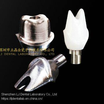Dental Implant Abutment, Implant Crown, Implant Prosthesis, Laboratoire Dentaire, Dentallabor, Laboratorio Dental, Dental Laboratory, Shenzhen LJ Dental Lab China photo-2