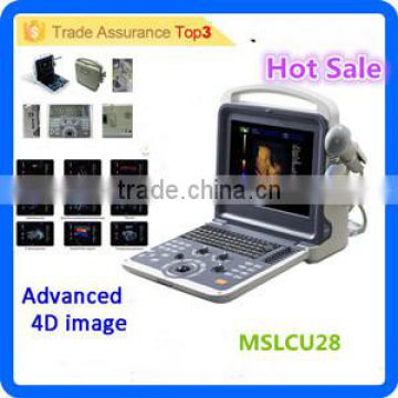 MSLCU28i full digital echo cardio vascular ultrasound portable colour doppler ultrasound