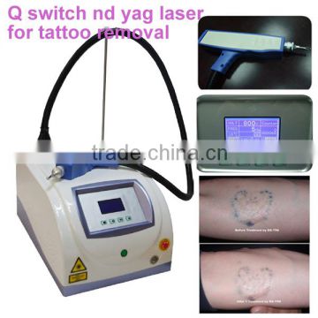 1 HZ Q Switch Laser Tattoo Removal Machine For Skin Tattoo Treatment 1-10Hz