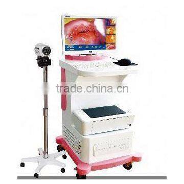 china digital video vaginal colposcope with ce