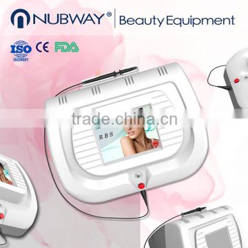 2016 Specials ! spider vein removal machine/acne treatment vascular spot removal