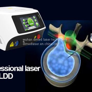 cherylas diode laser for Percutaneous Laser Disc Decompression (PLDD)