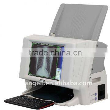 3G Medical Film Scanner