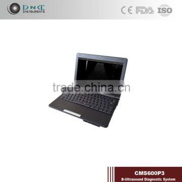 Super Quality Good Link Digital Non-Interlaced Portable Ultrasound Scanner 200D With Low Price photo-5