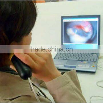 Endoscope camera factory price professional medical usb otoscope camera