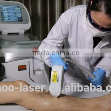 Professional depilacion laser 808 Diode body hair removers for man