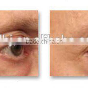 The Most Impressive Safe Beauty Therapy Radio Frequency For Home Use Portable Machine photo-6