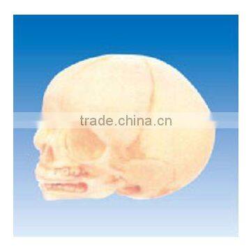 Infant skull model