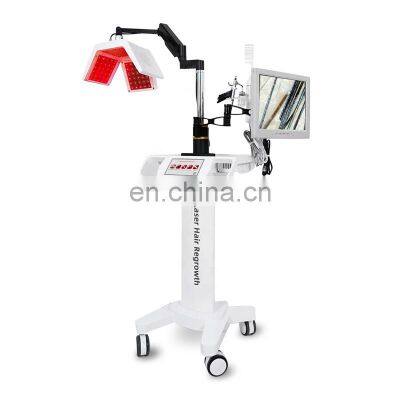 Factory Wholesale Hair Loss Treatment Hair Follicle Detection Machine 650nm Red Light Therapy Hair Growth Laser Equipment