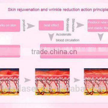 Opt Shr Multi-Functional Beauty Equipment photo-6